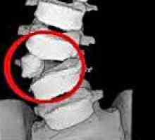 Аномалии на гръбначния стълб