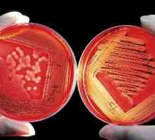 Бактериална шок в урологични заболявания