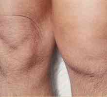 Болка в коляното (колянната става) на