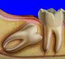Дистопичния зъби