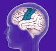 Доброкачествена епилепсия rolandic