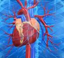 Хронична сърдечна недостатъчност: симптоми, лечение