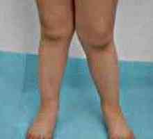 Извивката на долната част на крака