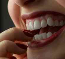 Корекция зъби (запушване) без скоби