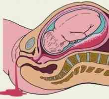 Кървене по време на бременност в ранните и късните етапи