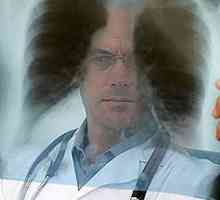 Белите дробове на пушачите да се променят на генетично ниво