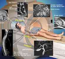 Магнитен резонанс (MRI). Показания, противопоказания, ядрено-магнитен резонанс