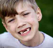 Млечните зъби при децата и тяхната промяна