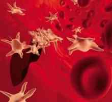 Ниските нива на тромбоцитите в кръвта