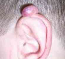 Тумори на ухото