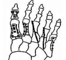Фрактури на костите на стъпалото и пръстите на краката при децата