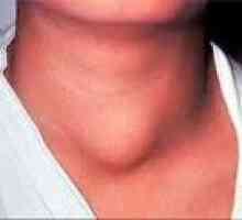 Рак на щитовидната жлеза