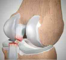 Скъсване на коленните сухожилия