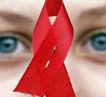Симптоми на HIV