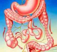 Синдром на дразнимото черво (IBS)