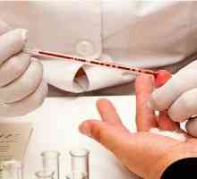 Склонност към altsgymera заболяване определи кръвен тест