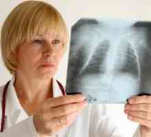 СЗО предупреждава за връщането на туберкулоза