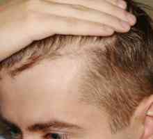 Загубата на коса при мъжете: причини, лечение, средство