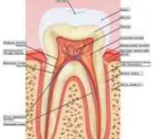 Заболяване на венците: гингивит, периодонтит (гума заболяване), пародонтоза