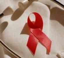 Жените са особено изложени на риск от ХИВ