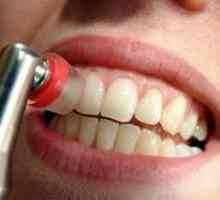 Зъбна плака (зъбна хигиена)