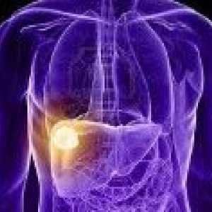 Доброкачествени тумори на черния дроб