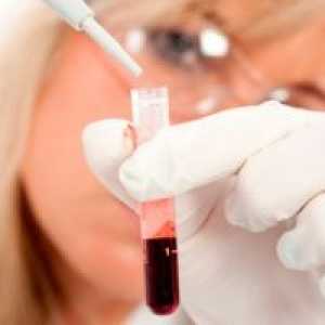 Кръв ще помогне да се определи склонността към заболяване