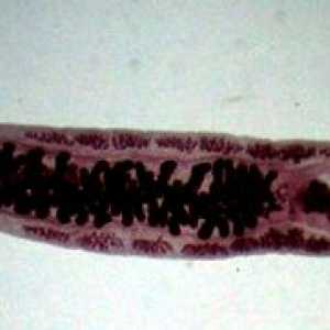 Opisthorchiasis (болест Виноградов е)