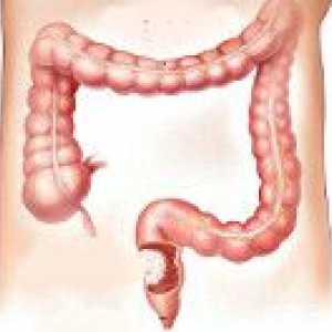Тумори на дебелото черво