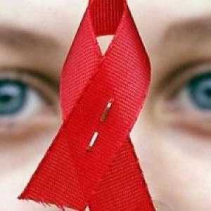 Симптоми на HIV