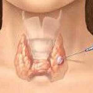Възли на щитовидната жлеза и кисти