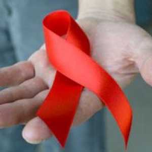 ХИВ инфекция и СПИН