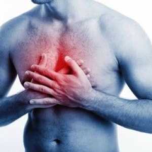 Изгарянето в гърдите: Причини